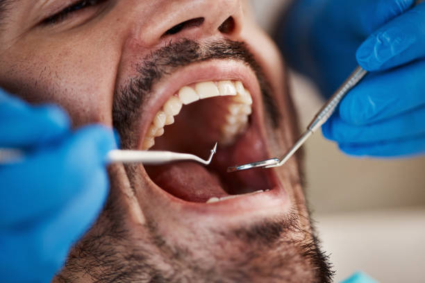 Best Dentist for Tooth Abscess  in Galatia, IL